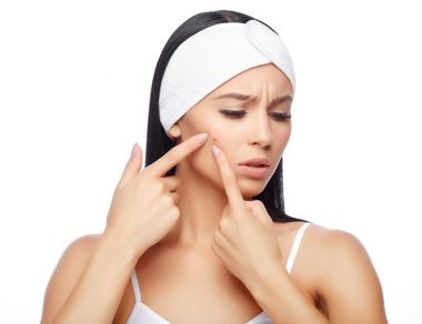 How to Safely Pop a Pimple